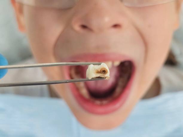Best Weekend Emergency Dentist in Pandora, OH